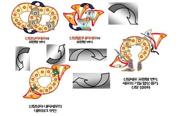 신장세포 표현형 변이, 내피-상피세포 네트워크 부전 및 신장섬유화의 연관성