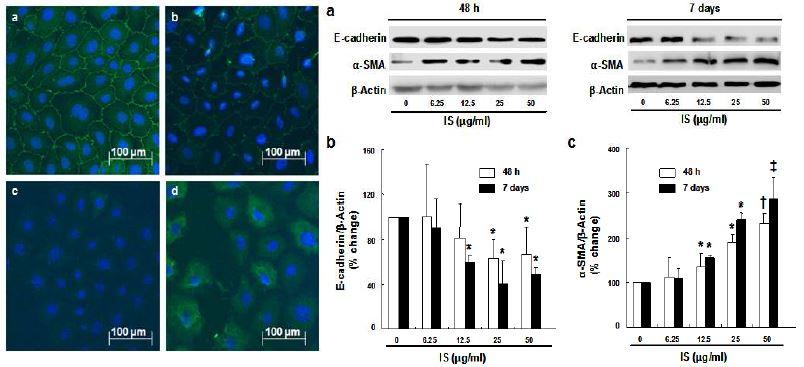 IS에 의한 신장상피세포의 EMT: 면역형광 염색 (좌측: a,b, ZO-1; c, d α-SMA; a,c control; b,d IS-stimulated NRK cells)과 western blotting (우측)그림 6. 요산에 의한 NRK cell의 EMT: 세포 형태의 변화 (좌측) 및 western blotting (우측)