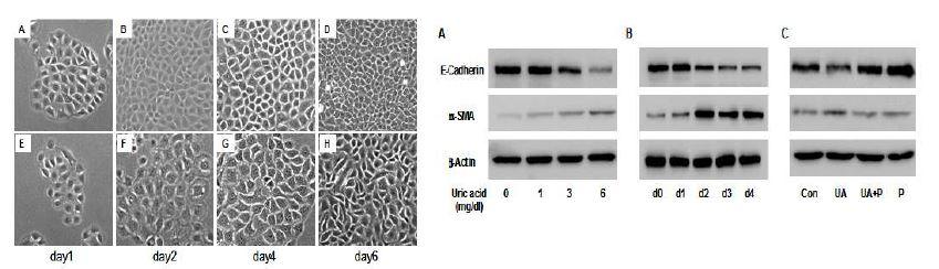 요산에 의한 NRK cell의 EMT : 세포 형태의 변화 (좌측) 및 western blotting (우측)