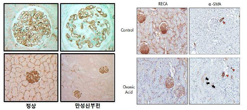 만성 신장병에서 신장의 Endo-MT: aging rat (좌측) 및 hyperuricemic rat (우측)