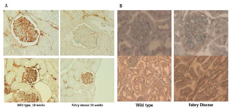 Fabry 마우스에서의 endo-MT: Decreased RECA Staining in Fabry Kidney (A) and an Accumulation of Gb3 in Glomerular Endothelial Cells and Renal Tubular Cells (B)