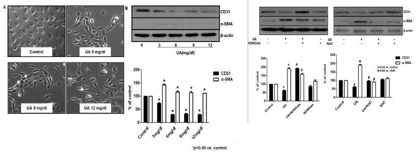 배양된 혈관 내피세포 (HUVEC, human umbilical vein endothelial cell)에서 요산에 의한 endo-MT 및 NO donor/anti-oxidant의 효과