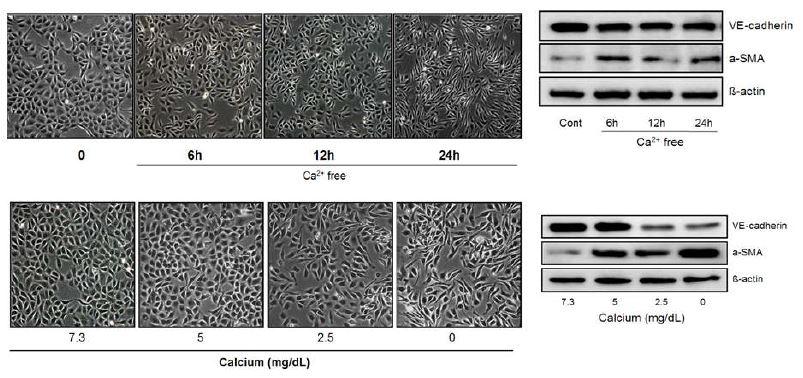칼슘 농도 변화에 의한 혈관 내피세포의 endo-MT: Time- and dose-dependency