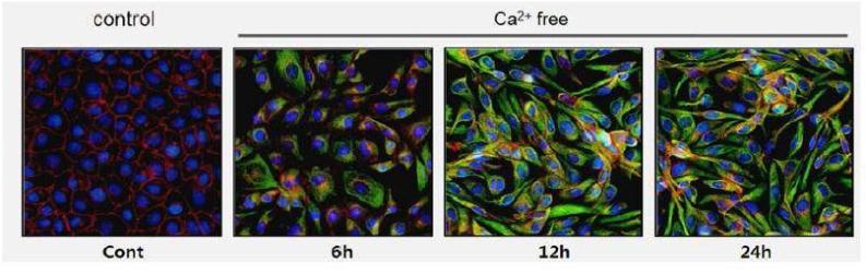 Low calcium-induced endo-MT in BAEC: Fluorescein Immunocytochemistry : VE-cadherin (red)의 세포질내로의 이동과 단백량 감소 및 de-novo expression of α-SMA (green)이 calcium-free 배양액을 사용한 경우 관찰됨.