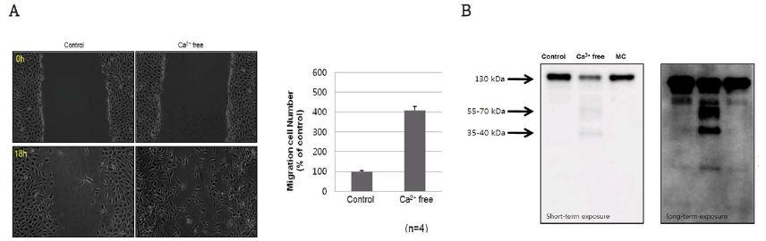 Low calcium-induced endo-MT in BAEC: Effect on Cell Motility (A)와 Calcium 농도 저하에 의한 VE-cadherin의 분해 (B) 그림 13. Reversibility of Low calcium-induced endoMT in BAEC 라-1-