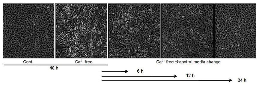Reversibility of Low calcium-induced endoMT in BAEC