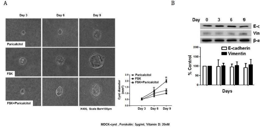 신장 상피세포의 in-vitro cyst 형성 및 paricalcitol의 cyst 형성 억제 효과 (A), Cyst 형성 과정젓 E-cadherin 및 vimentin의 발현 변화 (B)