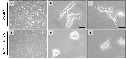그림 20. MMP9 유전자의 발현이 mIMCD-3의 tubulogenesis에 미치는 영향