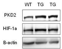 그림 22. PKD2 Tg 신장 조직에서 분리한 단백질로 western blotting 수행한 결과