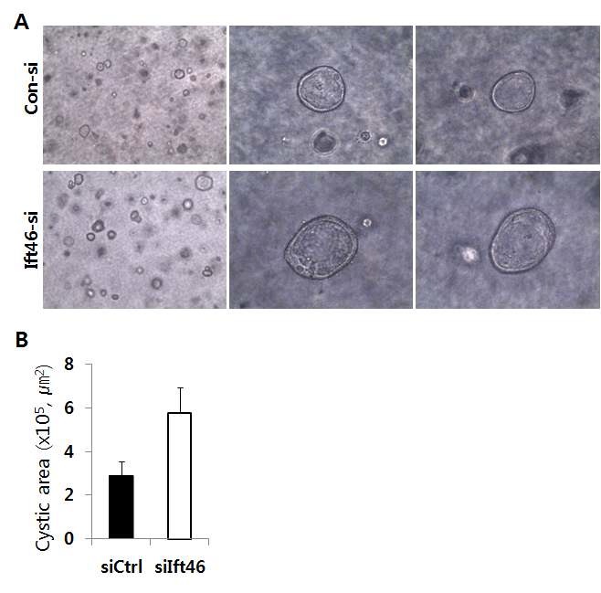 그림 37. Ift46 발현의 감소가 낭포 형성에 미치는 영향 검증
