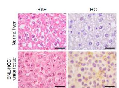 BNL-HCC 세포주 유래 암조직에 anti-TM4SF5R2-3 항체를 이용하여 immunohistochemistry