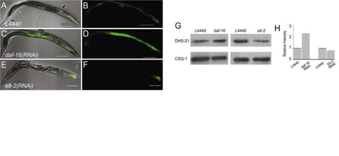 그림 10 daf-16과 elt-2의 dhs-21 발현에 대한 조절. RNAi 결과 daf-16은 전사 억제를 elt-2는 전사 유도를 하는것으로 보여짐