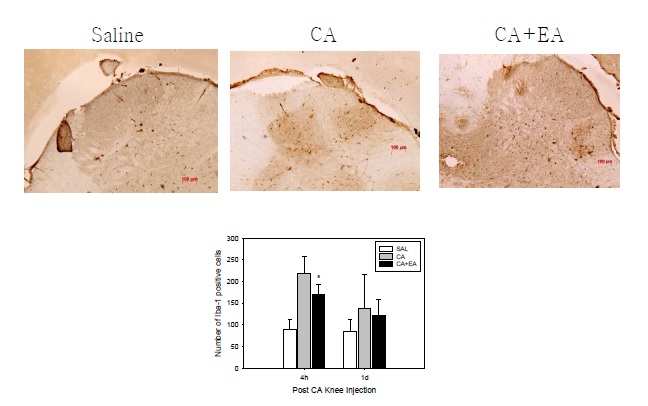 [전침의 microglia 활성 억제 효과]