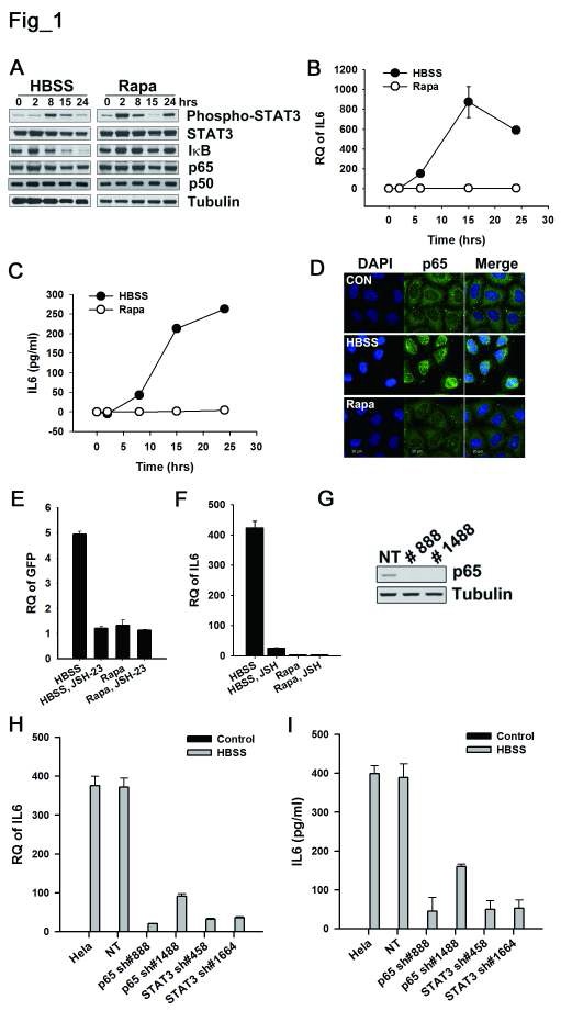 Figure 1. NF-kB activation is required for IL6 induction in starved cancer cells. A.