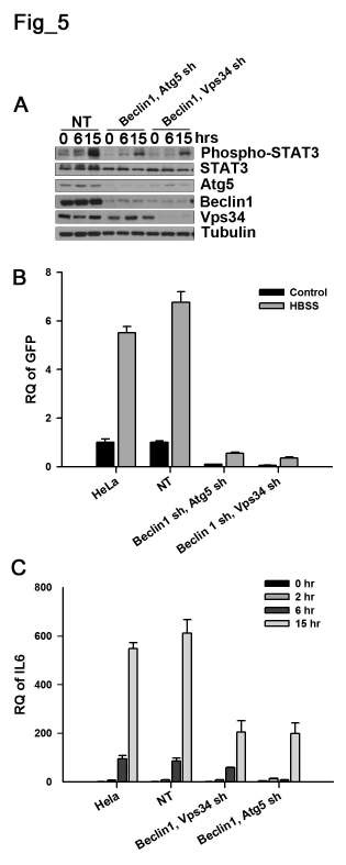 Figure 5. Autophagic process is implicated in NF-κB activation in starved cancer cells. A