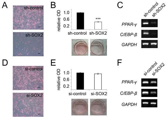 SOX2 억제에 따른 중간엽줄기세포의 지방분화력 비교