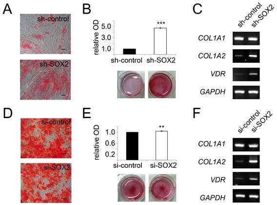 SOX2 억제에 따른 중간엽줄기세포의 골분화력 비교