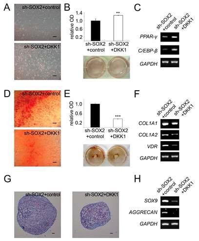 SOX2가 억제된 중간엽 줄기세포에서 DKK1의 증가를 통한 분화력 회복