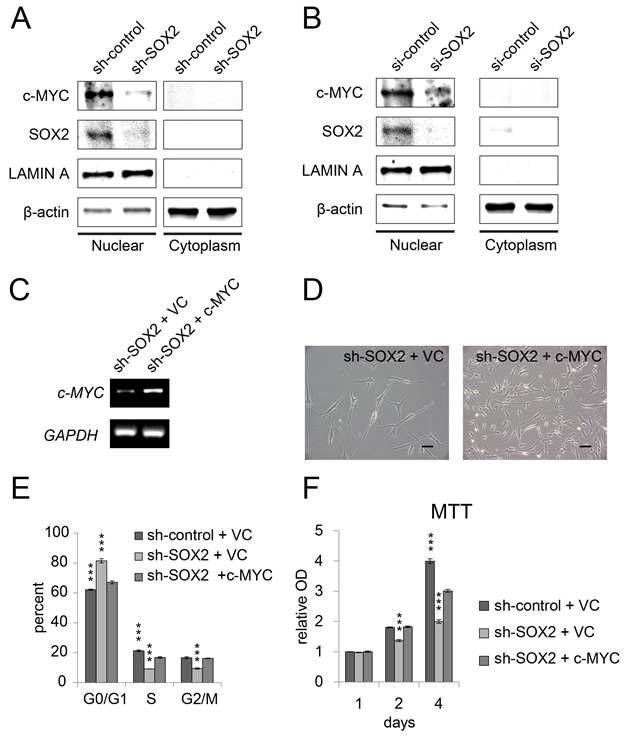 SOX2가 억제된 중간엽 줄기세포에서 c-MYC의 증가를 통해 회복된 세포 성장