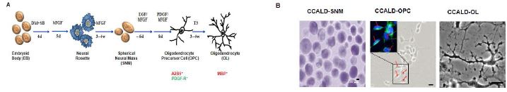 그림. ol igodendrocyte의 분화 protocol 을 나타낸 도식과 분화를 하는 과정의 사진들