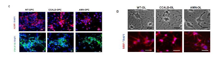 그림. 수립된 X-ALD 역분화줄기세포로부터 분화된 희소돌기교세포의 전구체와 성숙된 형태인지 실험적 검증