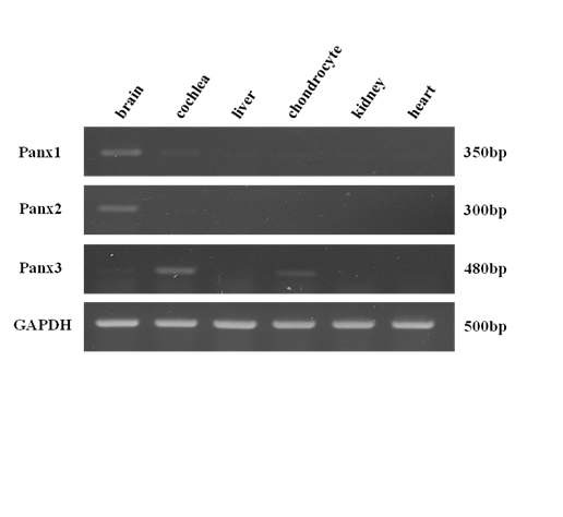 그림 1. 배아 13일째의 chicken의 뇌, 달팽이관, 간, 연골 그리고 신장에서 RT-PCR을 이용하여 분석한 Panx 유전자의 mRNA 발현 양상.