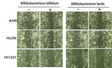 Fig 2. 비피더스균에 의한 비소세포폐암 세포성장 저해효과