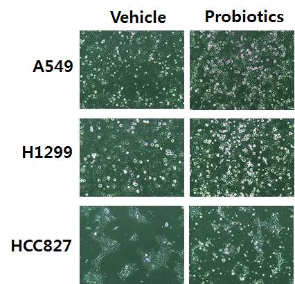 Fig 6. 다양한 탄소원을 함유한 배양액에서 성장한 Bifidobacterium 의 세포질 물질에 의한 비소세포성폐암세포주(A549, H1299, HCC827)의 형태학적 변화에 대한 효과