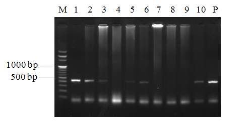 Fig. 4. Detection of MBV using RT-PCR from olive flounder (Paralichthys olivaceus) of aquafarm A (lane 1 and 2), aquafarm B (lane 3 and 4), aquafarm C (lane 5 and 6). aquafarm D (lane 7, 8 and 9), aquafarm E (lane 10), P, positive control; M, 1 kb DNA ladder