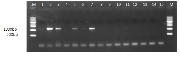 Fig. 5. Detection of VHSV using the RT-PCR from olive flounder (Paralichthys olivaceus) of aquafarm 1 (lane 1, liver; 2, kidney; 3, spleen; 4, brain and 5, intestine), aquafarm 2 (lane 3 and 4), aquafarm 3 (lane 5 and 6), aquafarm 4 (lane 7), aquafarm 5 (lane 8 and 9), aquafarm 6 (lane 10 and 11) and aquafarm 7 (lane 12). P, positive control; N, negative control; M, 1 kb DNA ladder.