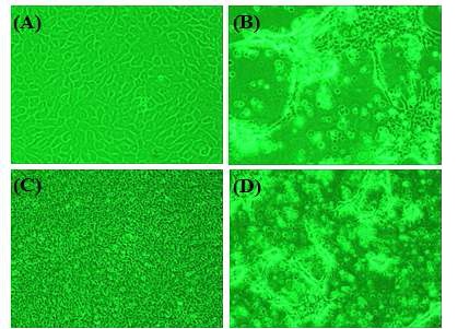 Fig. 8. CPE on susceptible cell lines infected VHSV isolate (J1) at 18℃ for four days.