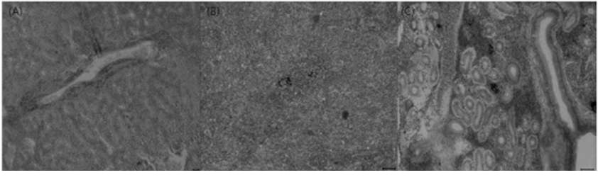 Fig. 10. Histopathological changes in diseased olive flounder P aralichthys olivaceus