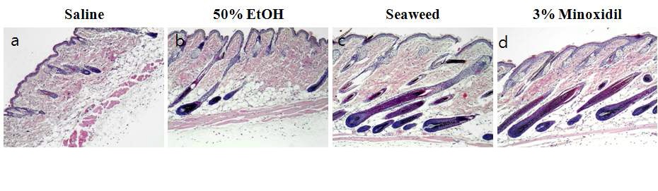 Figure 5. Histological change of hair follicles in the dorsal skin of C57BL/6 mice (H&E, ×40).The test compounds applied with 0.15 mL per to the dorsal skin of mice for 2 weeks