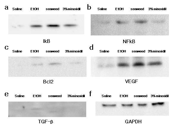 Fig 7,Immunoblot analysis of VEGF , Bcl2 and TGF-β in protein extracted from dorsal skin of C57BL/6 mice.