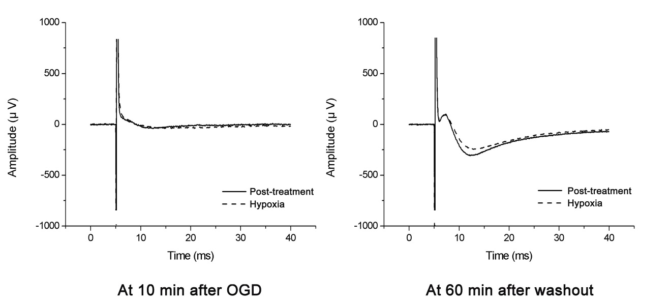 그림 12. 10 μM dexmedetomidine 후처리 (post-treatment)에 의한 field potential amplitude의 변화