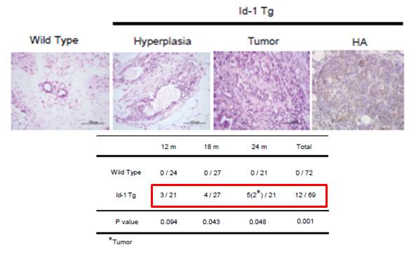 18개월째 야생형 암컷 마우스와는 다르게, 일부 Id-1/+ 형질전환 암컷 마우스에서 유관증식증과 고등급의 침습관상암종이 관찰됨.
