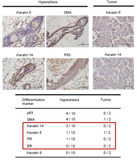 Id-1/+ 형질전환 암컷 마우스에서 형성된 유관증식증과 고등급의 침습관상암종 조직에서 basal 및 luminal marker 발현을 면역조직 화학법 (immunohistochemistry)을 통해 확인하였음.