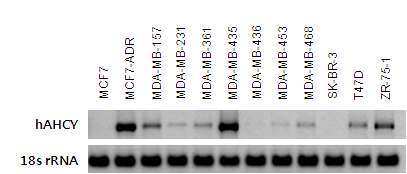 유방암세포주에서 Ahcy 유전자의 발현 확인