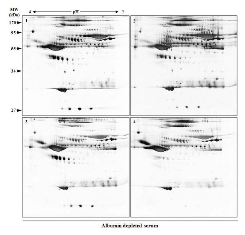 그림 6. Depleted serum에 대한 대표 2-DE gel