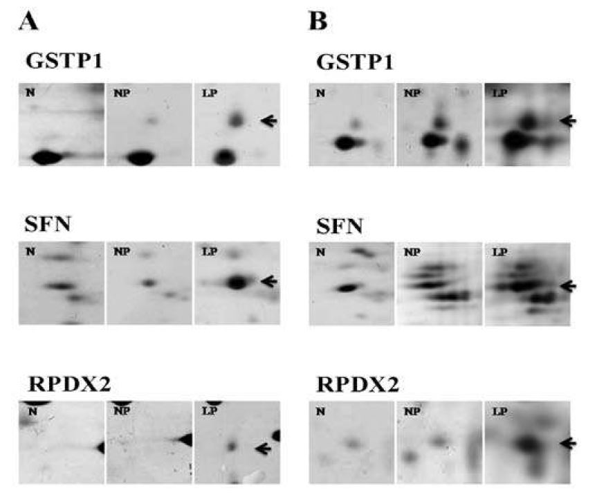 그림 10. 증가된 단백질들의 2-DE spot