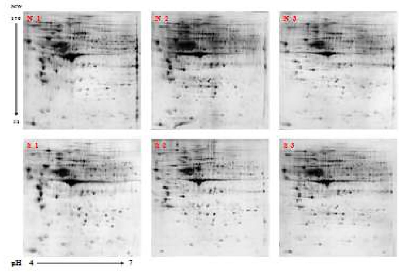 그림 13. 각 샘플에 대한 2-DE 프로테옴 분석 이미지