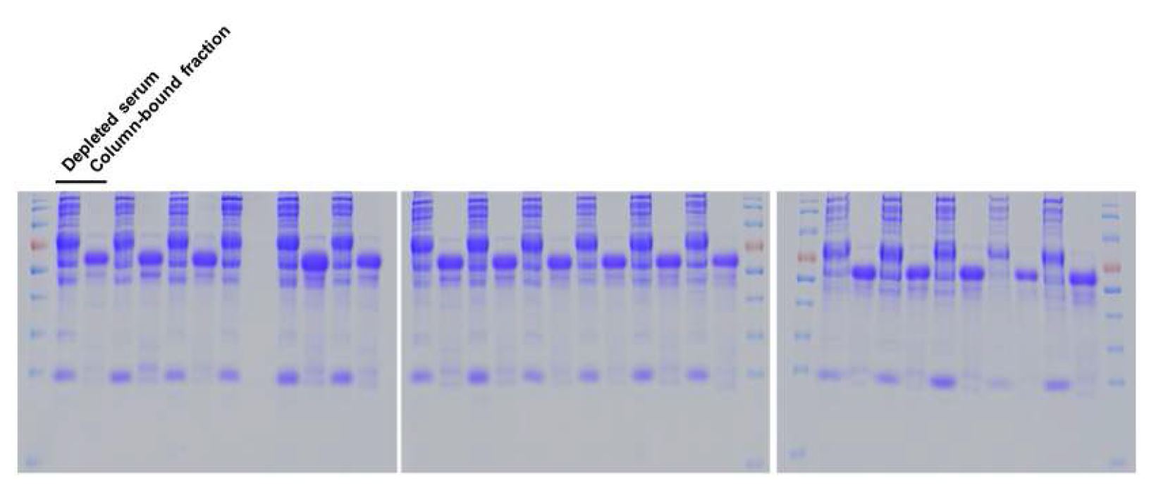 그림 16. depleted column 사용 전후 serum 단백질 비교