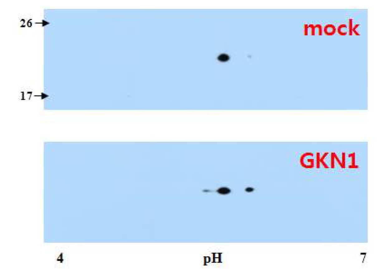 그림 20. GNK1발현을 확인하는 웨스턴 결과