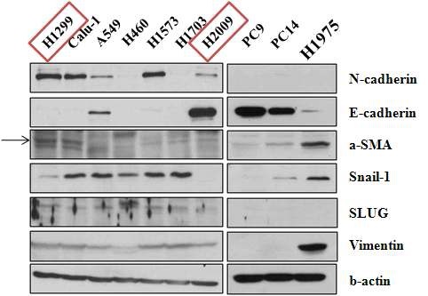 그림 4 NSCLC의 EMT 관련 단백질의 발현