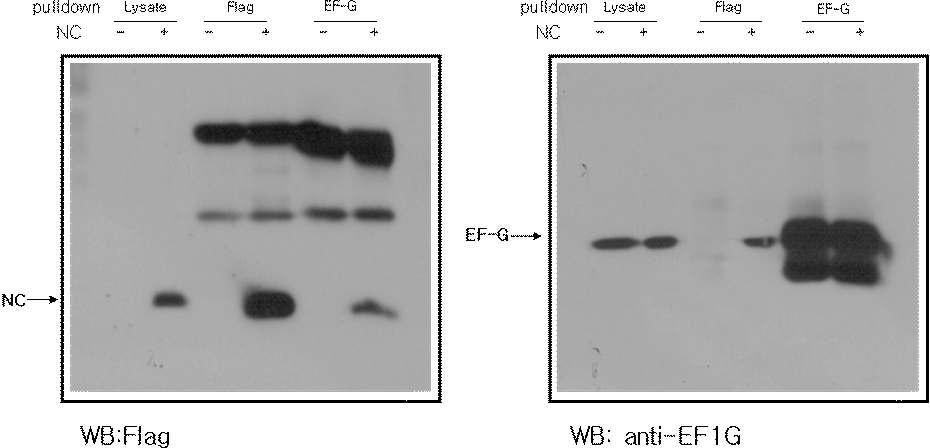 Interaction between HIV-NC protein and eEF1G