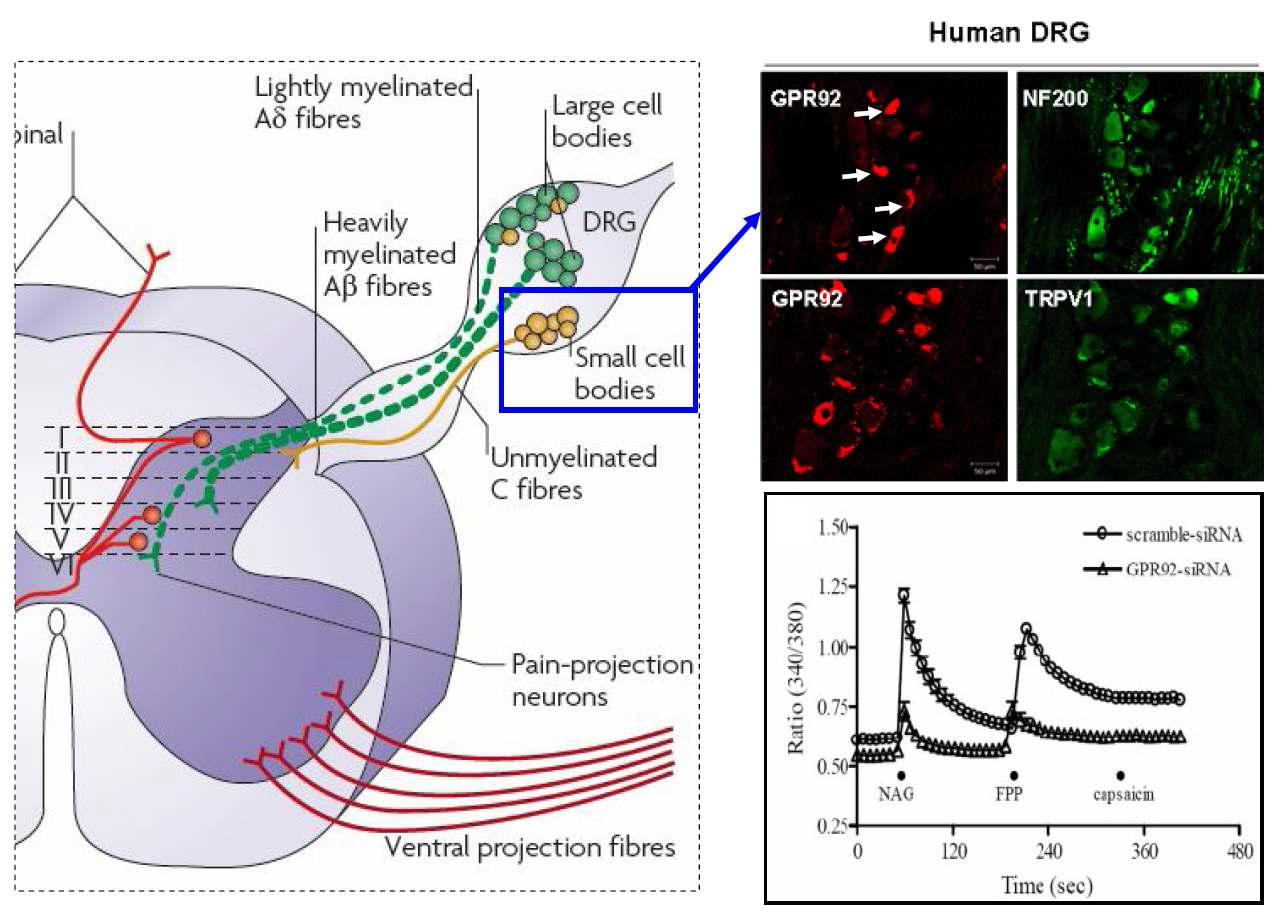 GPR92의 인간 배근신경절 세포에서의 발현 및 기능