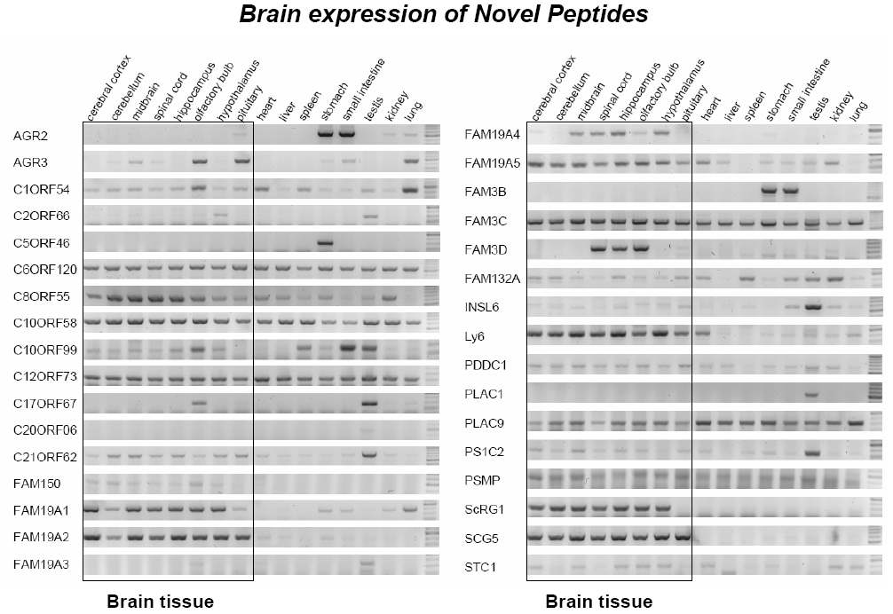 신규 GPCR 리간드 후보 유전자의 조직 발현: 각 유전자의 exon-intron 분석 후 specific primer를 제작하여 각 tissue에서 추출한 RNA를 이용하여 RT-PCR을 수행.