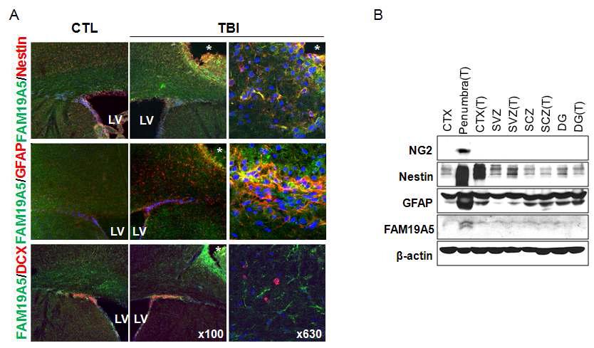 뇌손상 이후 손상부위의 FAM19A5 단백질의 발현 증가