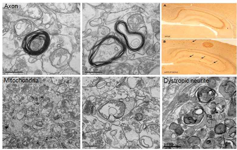 [APP mutant 생쥐 brain의 AD lesion에서 세포소기관의 미세구조적 이상]