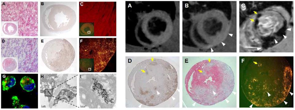 합성한 MRI/FI 다중프로브를 이용하여 심근염 염증부위애 국소적으로 침윤된 면역세포에 의한 inflammation 관찰 및 진단